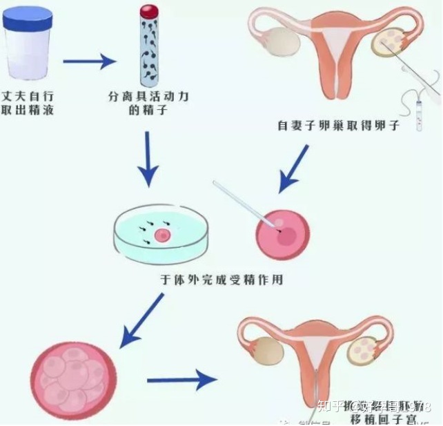 俄罗斯的借卵供卵代生代怀价格，请看费用明细