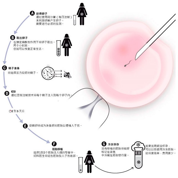 供卵借卵做试管代怀移植后感到腹胀是否正常