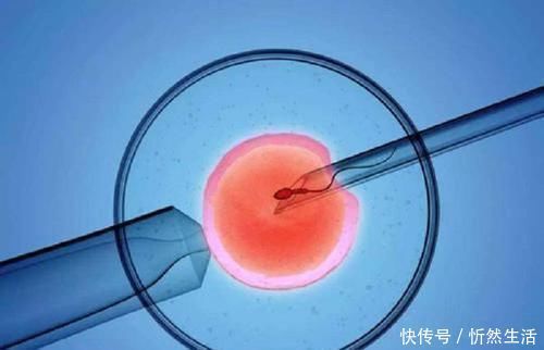 做试管卵泡最大多少