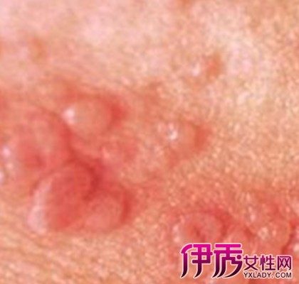 兰州哪家医院可以做私人医院做代怀男孩