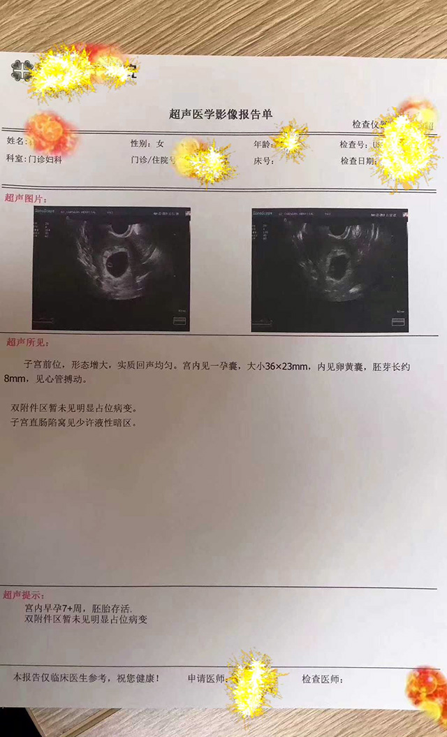 双胞胎兰州的试管代怀妈妈是同卵还是异卵