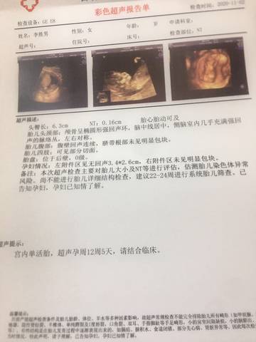 试管促排长方案和短方案哪个对卵巢刺激更小