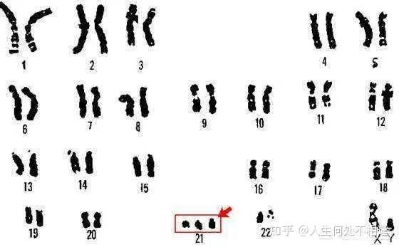 精子库精子提供学历吗