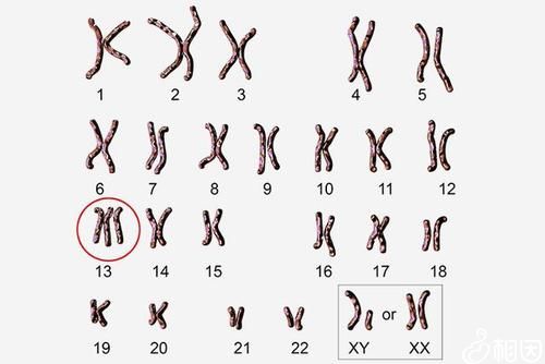精子库精子提供学历吗