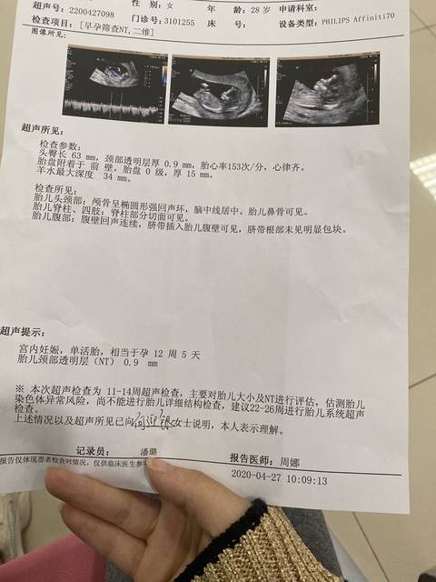 兰州借卵自怀流程哪家最好（正规吗,费用高不高？）