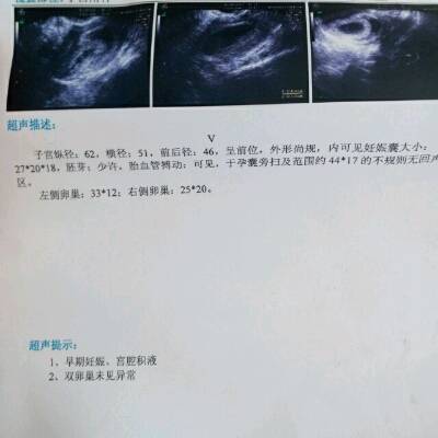 兰州兰州供卵+兰州试管助孕中介机构