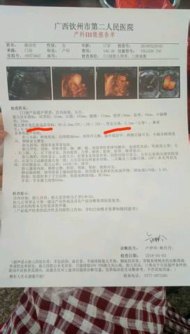 我孩子是供卵（供卵孩子与母亲的感情）